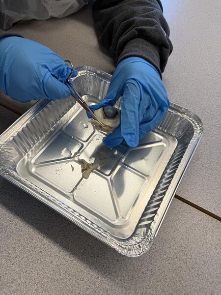 Eye Dissection